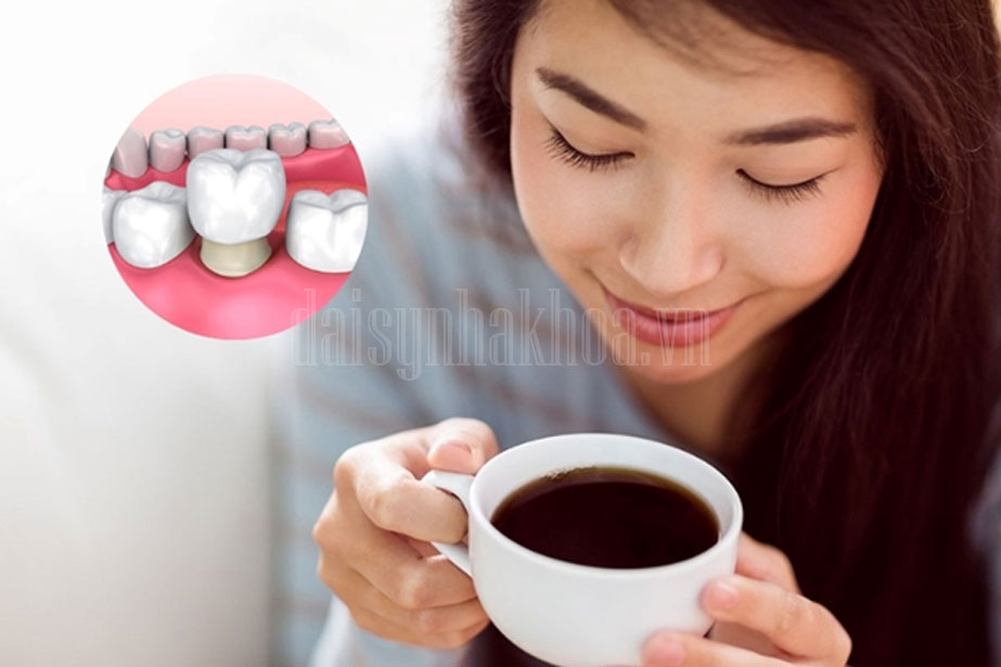  [Giải đáp] Bọc răng sứ có uống cà phê được không? 