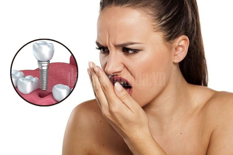  Trồng răng Implant có gây hôi miệng không? Giải đáp cụ thể ở đây