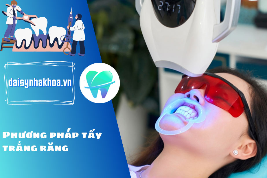 Tẩy trắng răng là phương pháp dùng thuốc bôi kết hợp với ánh sáng laser để loại bỏ phân tử sẫm màu trên răng