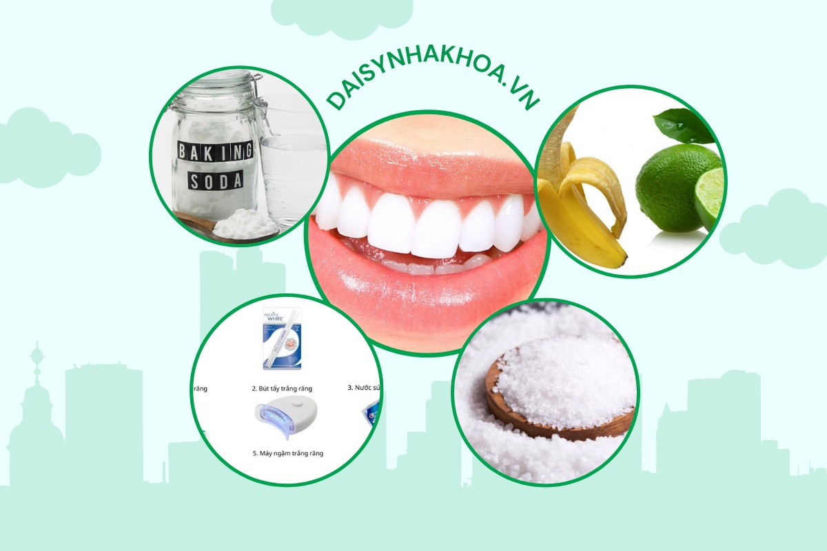  Top 4 Cách làm trắng răng bị ố vàng an toàn hiệu quả tại nhà