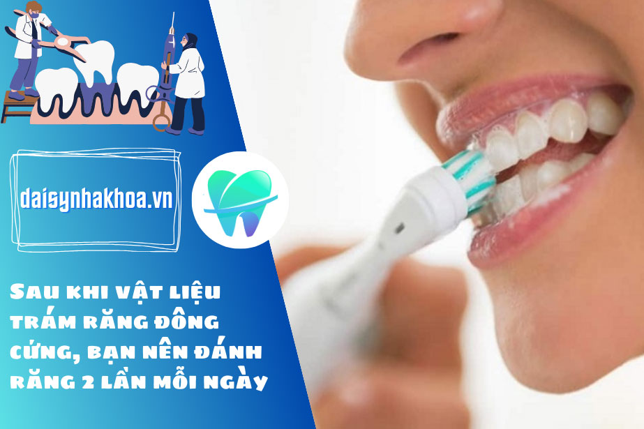 Sau khi vật liệu trám răng đông cứng, bạn nên đánh răng 2 lần mỗi ngày để bảo vệ răng miệng và duy trì tuổi thọ miếng trám.