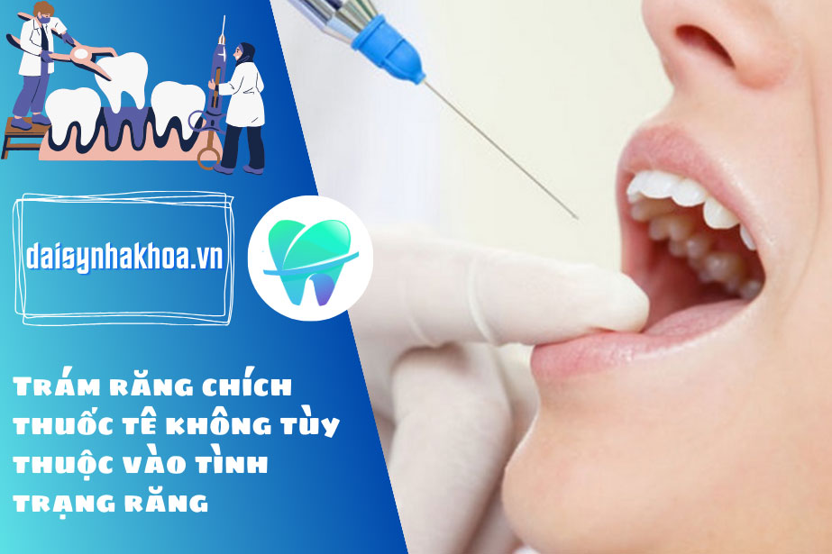 Trám răng chích thuốc tê không tùy thuộc vào tình trạng răng của bệnh nhân và được quyết định bởi bác sĩ.