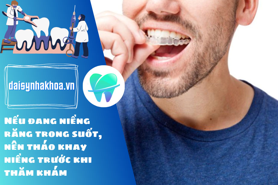 Nếu đang niềng răng trong suốt, nên tháo khay niềng trước khi thăm khám để bác sĩ đánh giá kết quả chính xác hơn