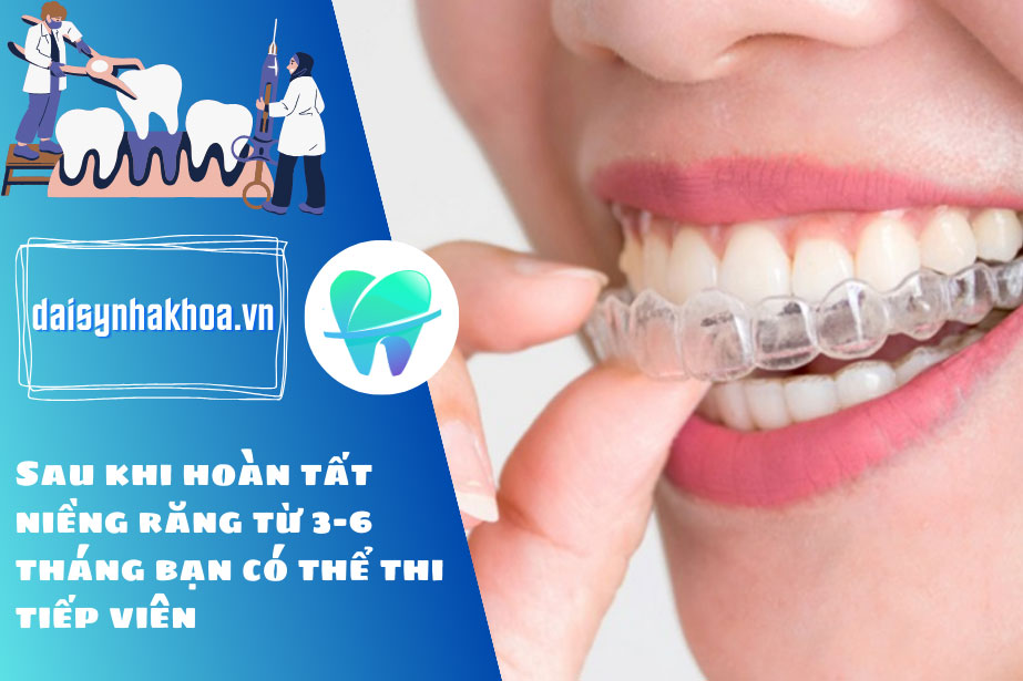Sau khi hoàn tất niềng răng từ 3-6 tháng bạn có thể thi tiếp viên.