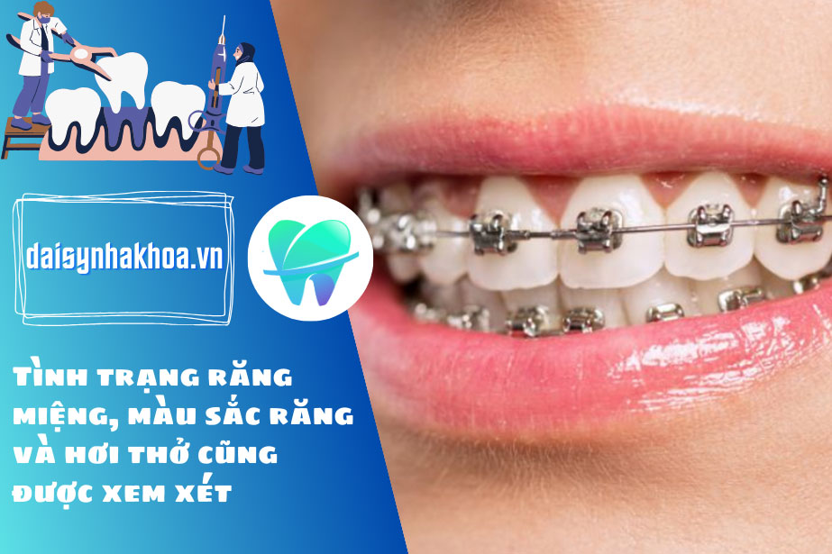 Tình trạng răng miệng, màu sắc răng và hơi thở cũng được xem xét trong quá trình khám sức khỏe răng hàm mặt