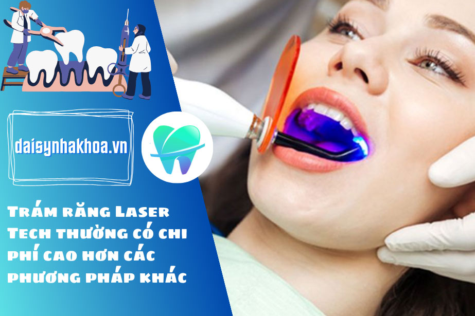 Trám răng Laser Tech thường có chi phí cao hơn các phương pháp khác